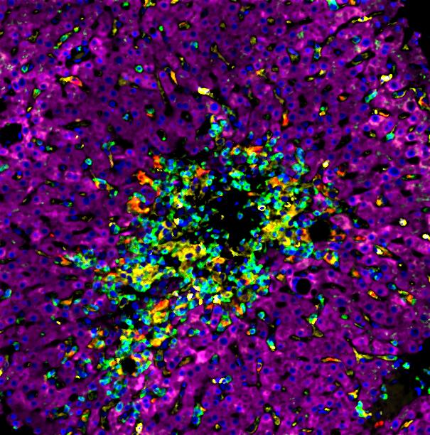 Fluorescence microscopy of liver tissue, Dara Lab USC